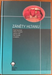 kniha Zánět hltanu, Tobiáš 2016