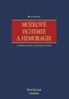 Mozkové ischemie a hemoragie