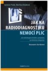 Jak na radiodiagnostiku nemocí plic